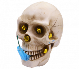 HAPPY BONES- CASE 12/1